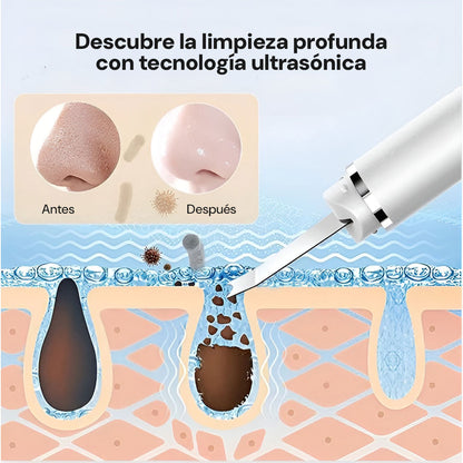 DermaGlow | Limpieza Facial Ultrasónica Avanzada