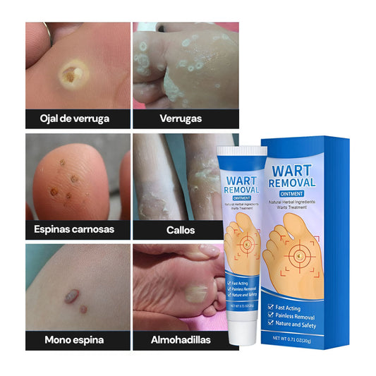 Wart-Removal | Elimina Verrugas en días sin molestias